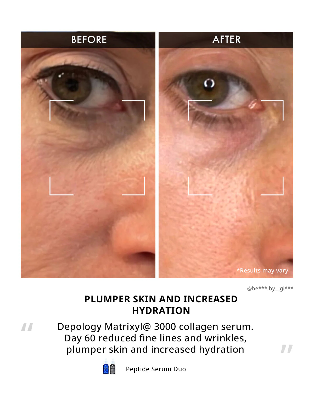 LUMÈ - Renewal Notox Serum